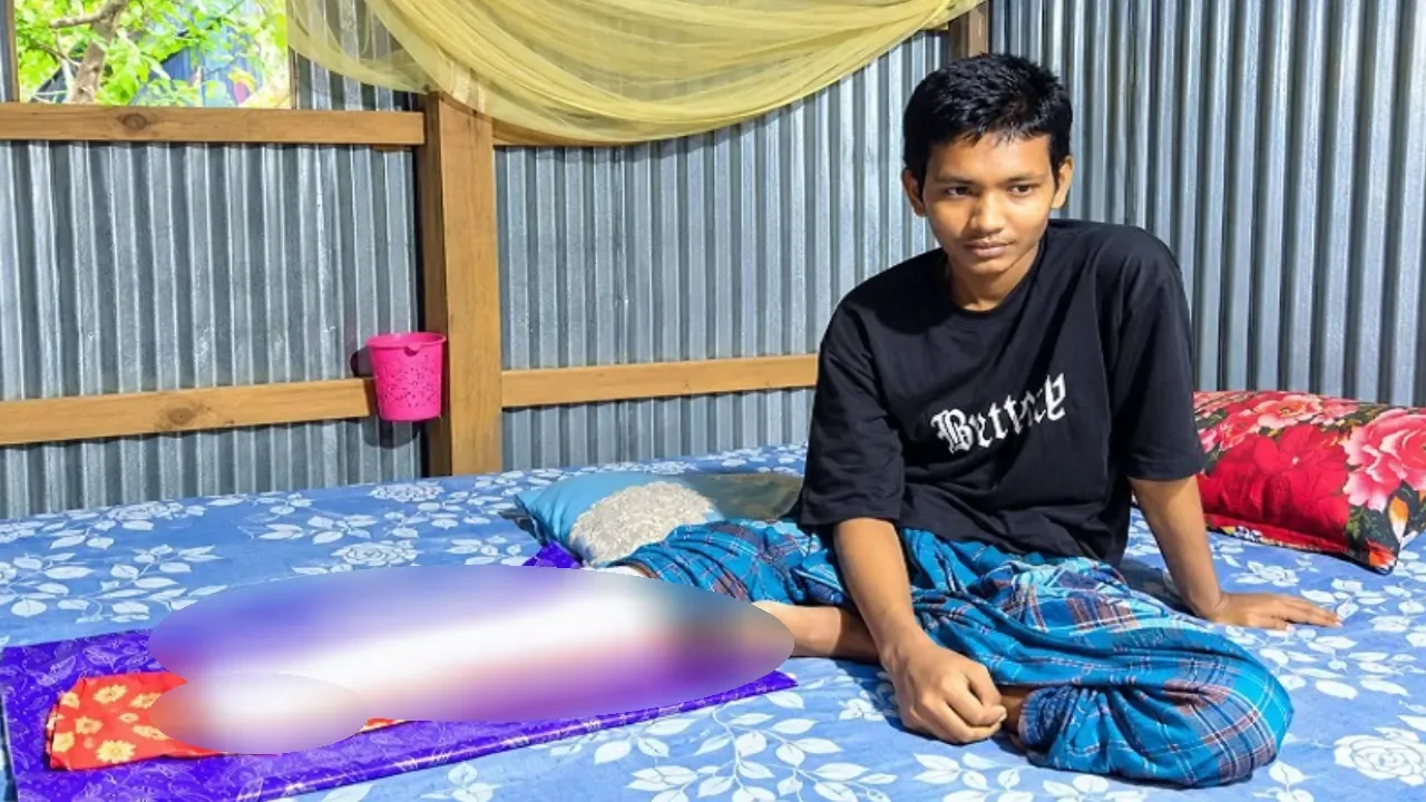 অর্থাভাবে চিকিৎসা বন্ধ, পচন ধরেছে আশরাফুলের পায়ে